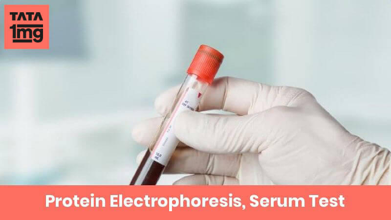 Protein Electrophoresis, Serum
